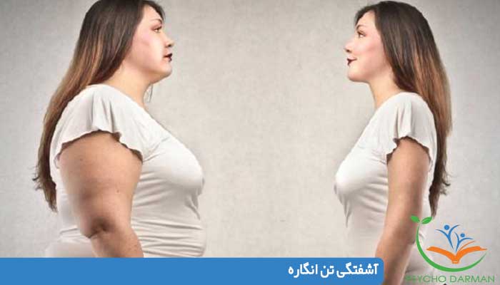 آشفتگى تن انگاره