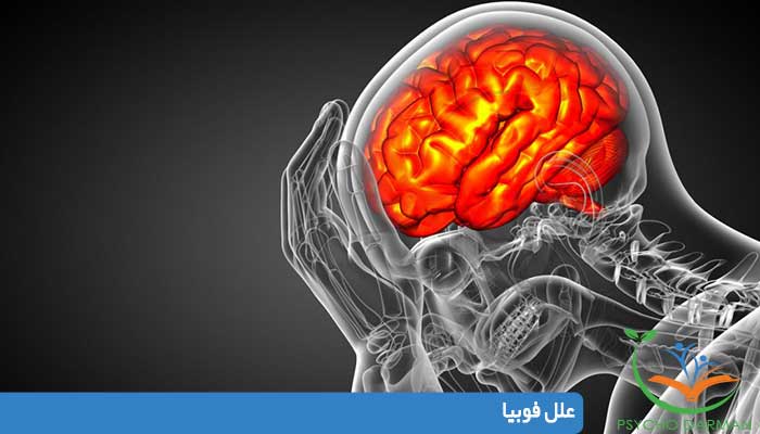 علل فوبیا