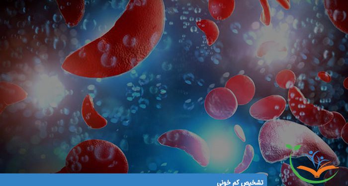 تشخیص کم خونی